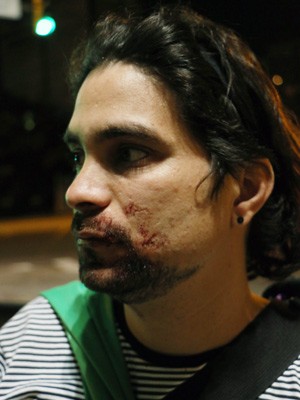 José Daniel Menezes diz ter sido espancado em Porto Alegre (Foto: Leo Urnauer/G1)