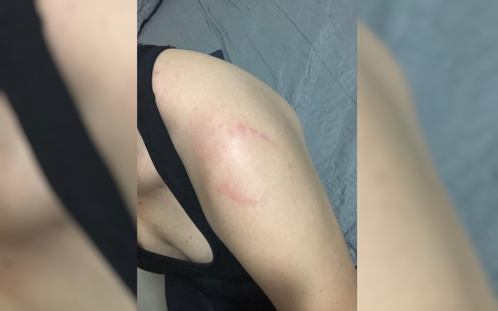 Jovem leva mordida no ombro após se esbarrar em homem em academia de Rio Verde; vídeo — Foto: Divulgação/Polícia Civil