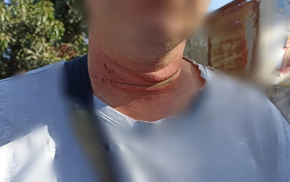 Motociclista fica com pescoço ferido após bater em fio solto em Anápolis— Foto: Reprodução/CBM-GO