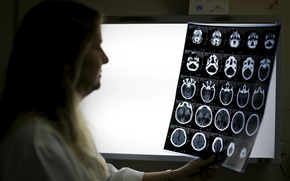  Especialista observa exame de imagem de um bebê com microcefalia em hospital do Recife, em foto de 26 de janeiro de 2016 (Foto: Reuters/Ueslei Marcelino)