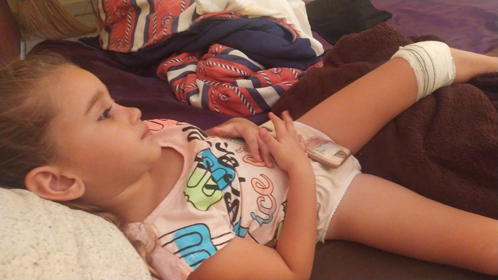 Criança que acompanhava jogo do Brasil com a mãe é mordida por macaco em praça de Balbinos — Foto: Sthefany Nathália da Silva Araújo /Arquivo pessoal