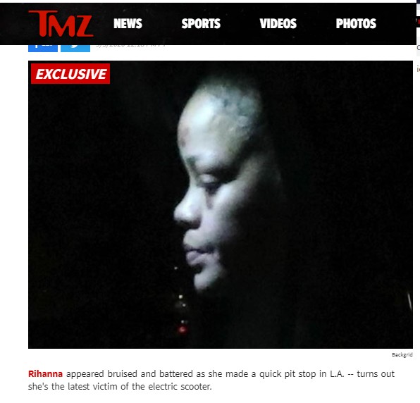 Rihanna aparece com rosto machucado após acidente (Foto: Reprodução / TMZ)