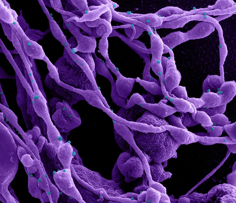 Micrografia eletrônica de varredura colorida de uma célula (roxa) infectada com partículas do vírus Sars-CoV-2 (azul) (Foto: NIAID)