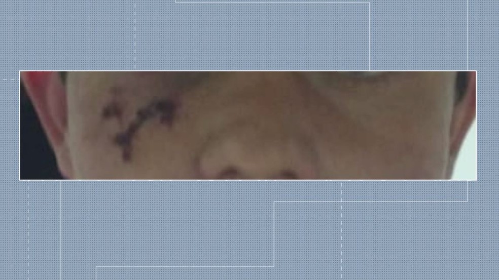 Laudo do IML concluiu que jovem foi agredido durante a ação policial, em uma abordagem de briga de vizinhos, em Curitiba — Foto: Reprodução/RPC