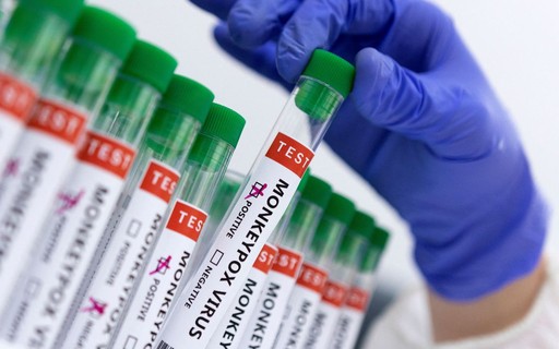 Alors que les infections augmentent, un nouveau centre de vaccination contre la variole du singe ouvre à Paris