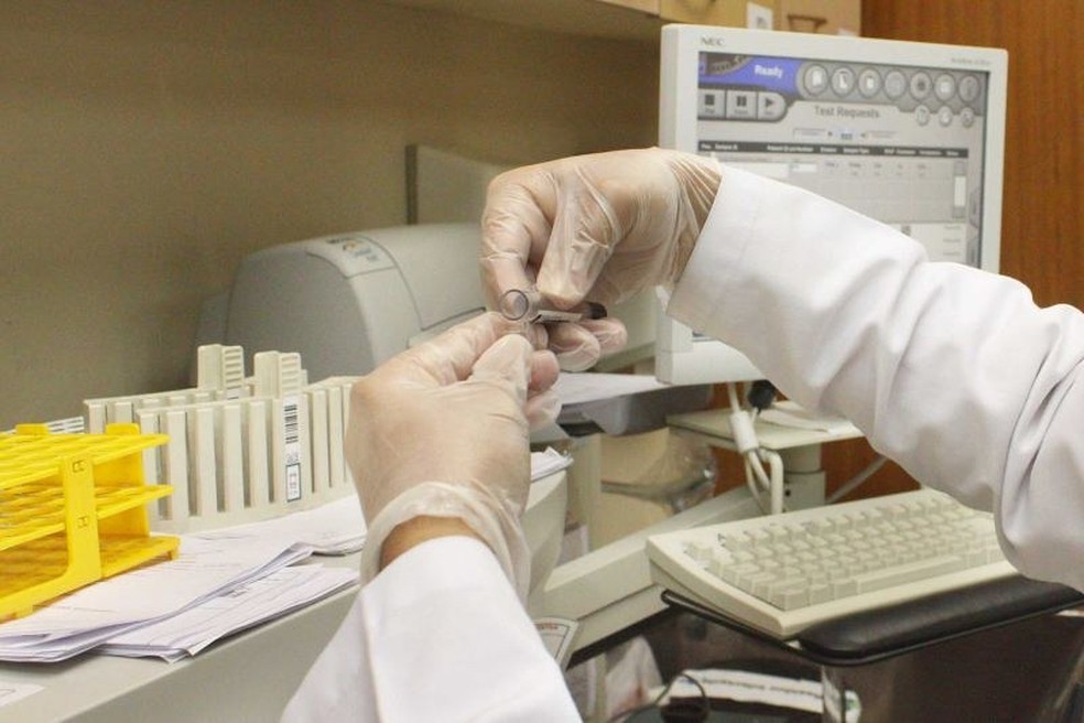 MP de Contas estadual investiga compra de luvas cirúrgicas — Foto: Divulgação