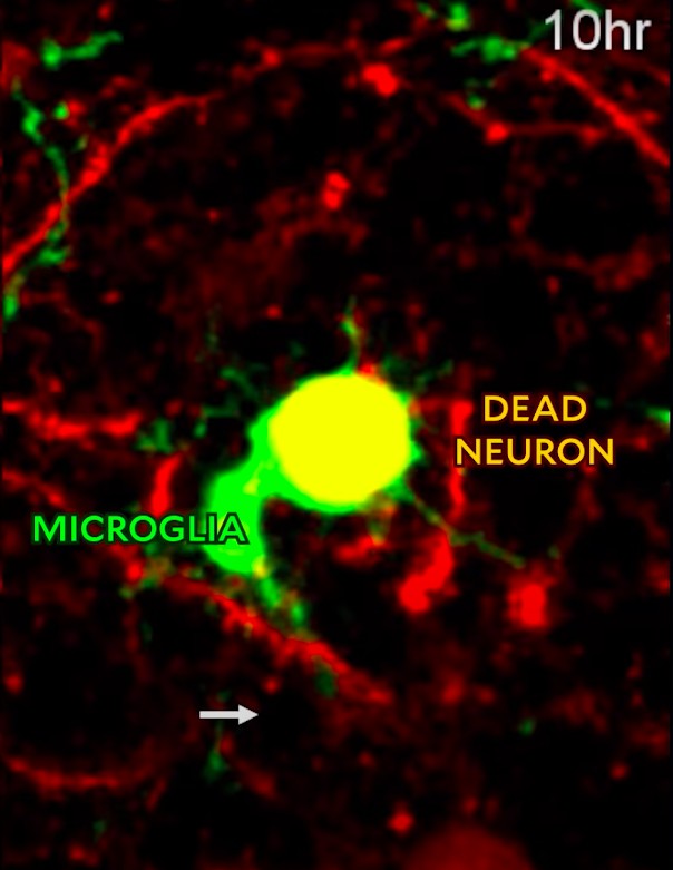 Cientistas conseguem gravar, em vídeo, momento em que as células do cérebro eliminam neurônio morto (Foto: Reprodução/Yale)