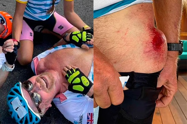 Richard Branson e o acidente sofrido em acidente ciclístico (Foto: reprodução instagram e divulgação)