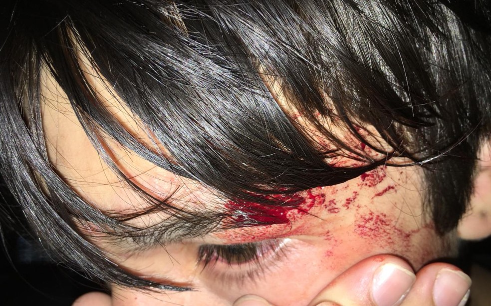 Adolescente ficou ferido após confusão na comemoração da vitória de Jair Bolsonaro em Botucatu  — Foto: Murilo Rincon / TV TEM 