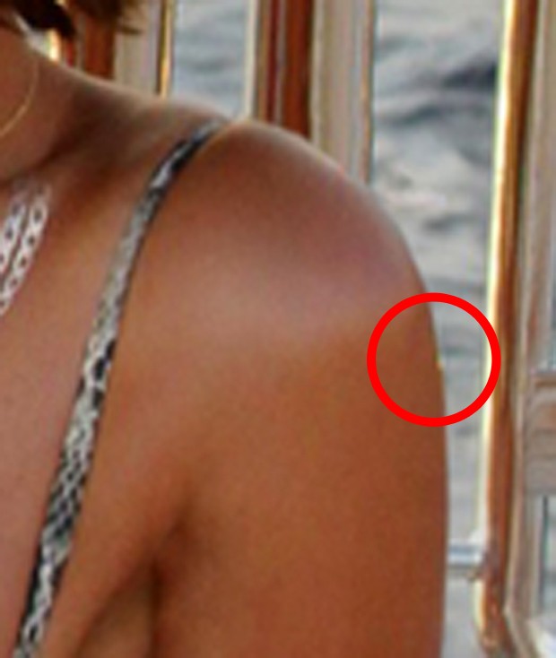 Detalhe do braço alterado de Beyoncé (Foto: Reprodução/Beyoncé)