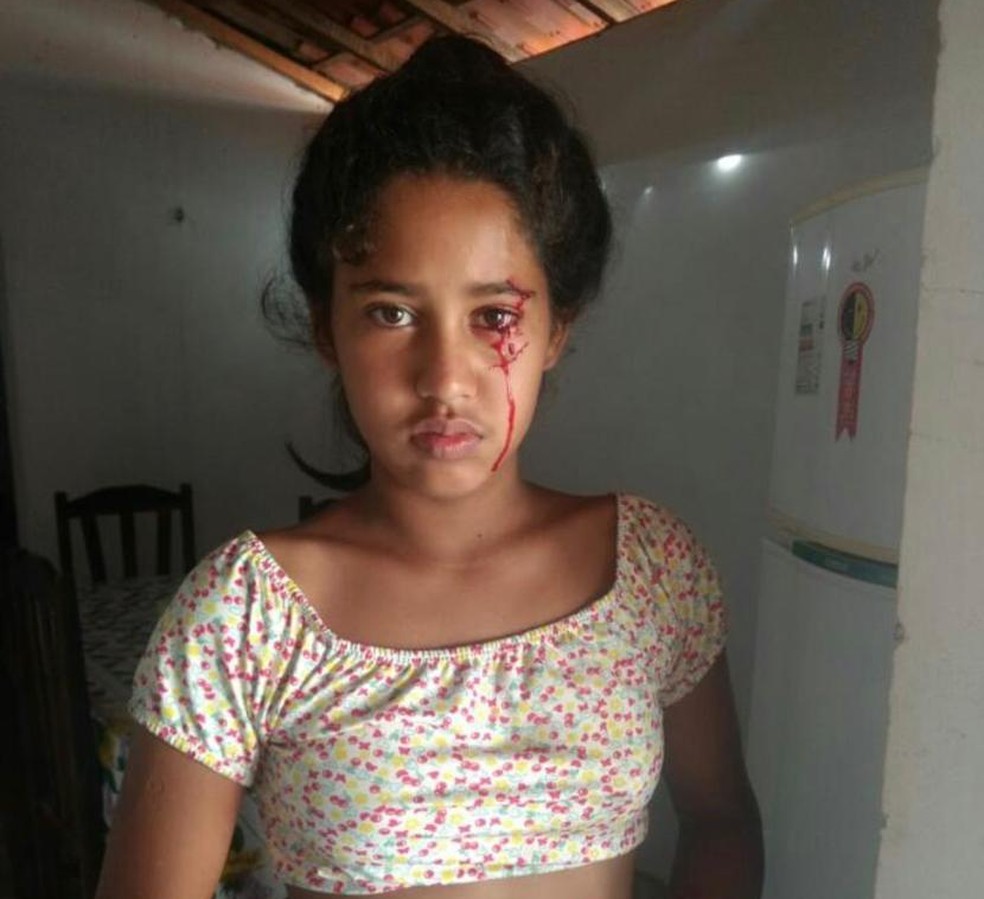 Menina de 12 anos sangra pelos olhos e assusta família no Norte do Piauí — Foto: Arquivo pessoal/ Luciana Barbosa