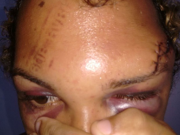 Garçom foi espancado e teve testa marcada após sair de bar em Salvador (Foto: Arquivo pessoal)