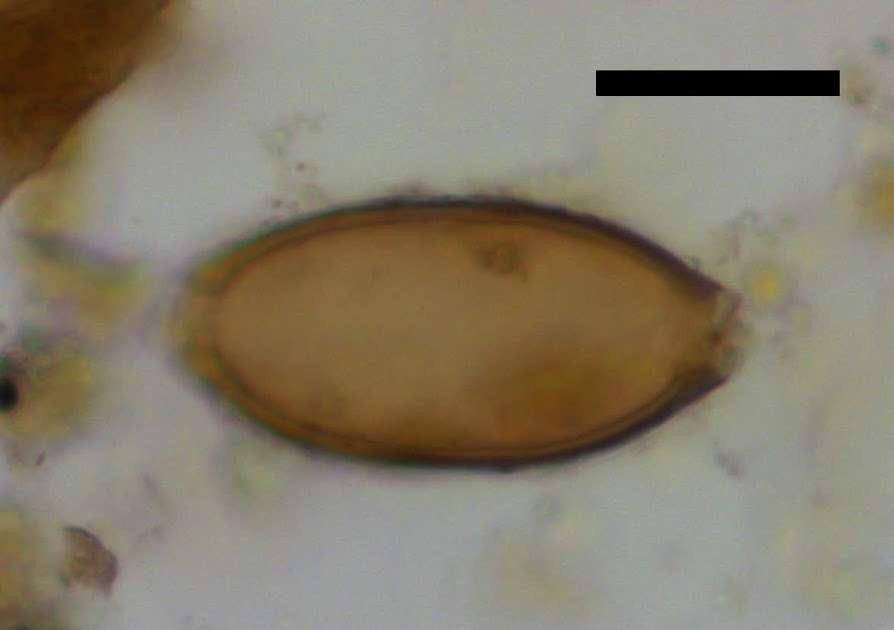 Ovo de um parasita Trichuris, encontrado por pesquisadores na vila Çatalhöyük (Foto: Universidade de Cambridge)