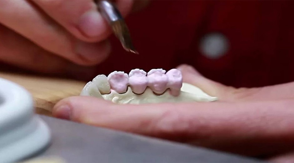 Prótese dentária: material sem controle põe paciente em risco (Foto: Reprodução )