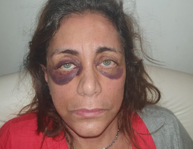Karen Keldani agrediu a própria mãe, Dona Nely Keldani (Foto: Arquivo pessoal)