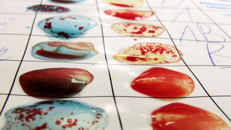 Teste de identificação de tipos sanguíneos — eles já foram associados a maior ou menor risco para doenças como malária e hepatite B (Foto: Getty Images)