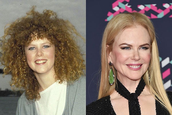 Nicole Kidman (em 1983 e em 2016) (Foto: Getty Images)
