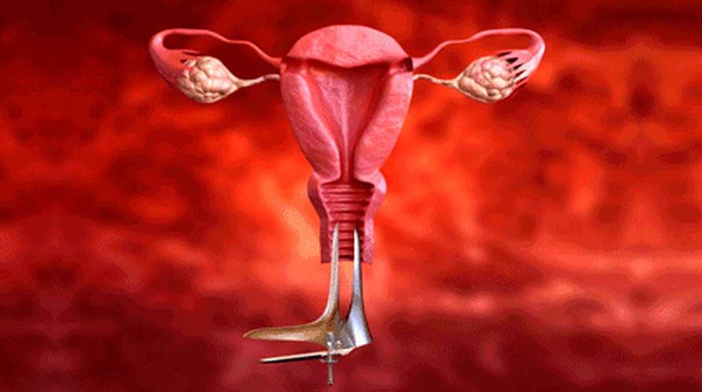 Como Se Prevenir Do Cancer De Colo De Utero Outubro Rosa Cortes Villela G1