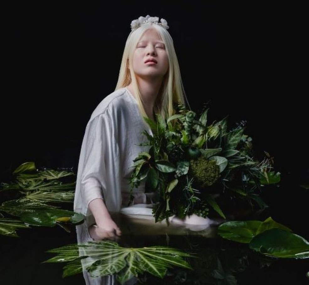 A chinesa albina abandonada bebê que se tornou modelo da Vogue | Mundo | G1