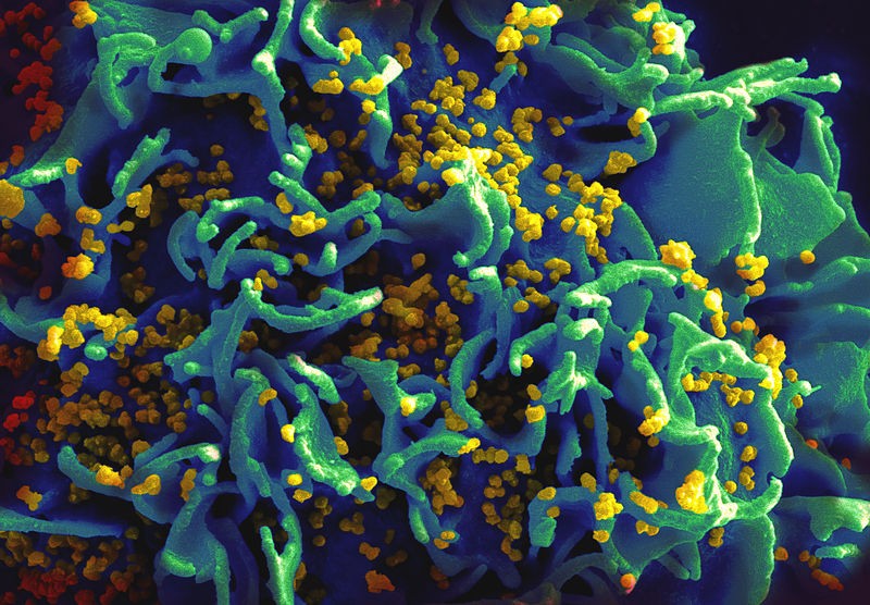 HIV (Foto: National Institutes of Health (NIH)/ Wikimedia Commons)