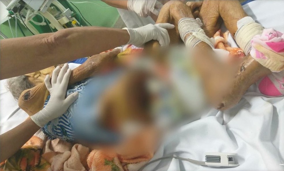Francisca das Chagas Oliveira foi encontrada com feridas na pele e doente na cidade de Vargem Grande, no Maranhão — Foto: Reprodução/TV Mirante
