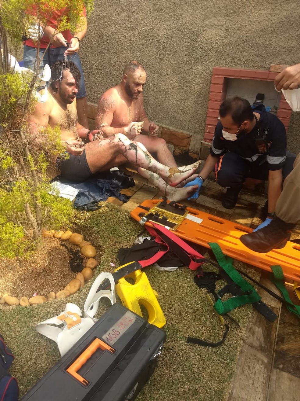 Srrael Campras dos Santos (à esq) teve 32% do corpo queimado. — Foto: Jackson Nogueira