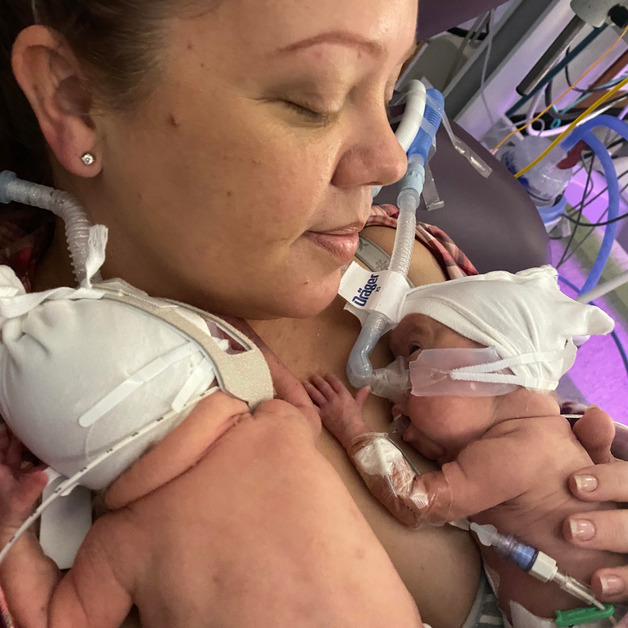 Mãe celebra recuperação de gêmeos que nasceram às 22 semanas de gestação (Foto: Reprodução/Facebook/Jade Crane)
