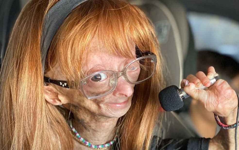 Adalia Rose Williams era portadora de progeria, ou síndrome de progeria de Hutchinson-Gilford (HGPS) — Foto: Reprodução/Instagram/Adalia06