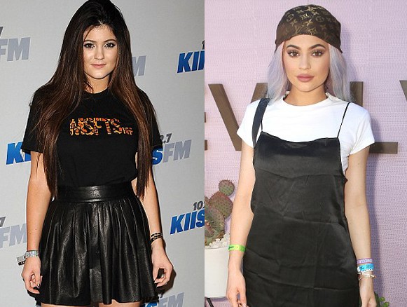Antes e depois de Kylie Jenner (Foto: Reprodução)