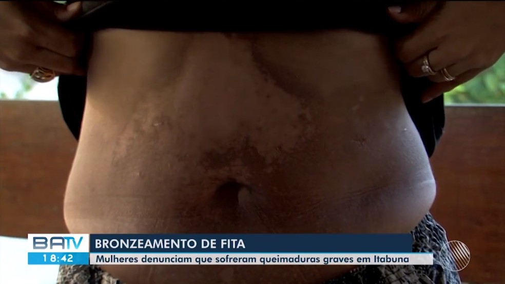 Spa Bronze Perfeito Clinica De Bronzeamento Natural Rio De Janeiro
