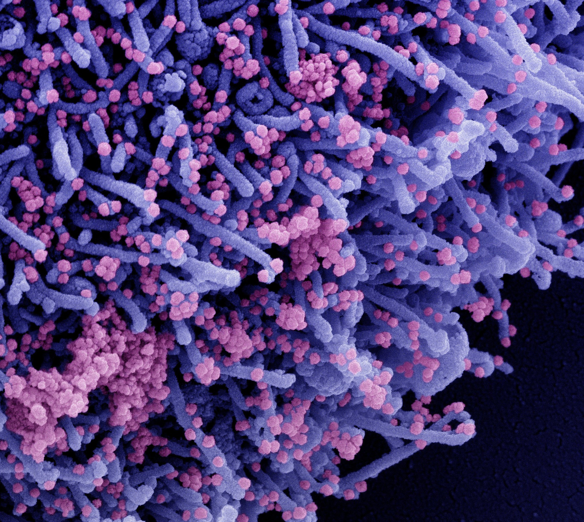 Micrografia eletrônica de varredura colorida de uma célula (roxa) infectada com uma cepa variante de partículas do vírus Sars-CoV-2 (rosa), isolada de uma amostra de paciente (Foto: NIAID)