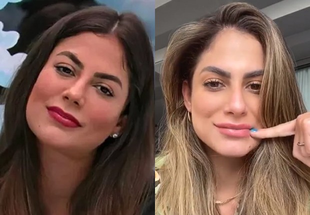 Mari Gonzalez antes e depois do preenchimento labial (Foto: Reprodução/Instagram)