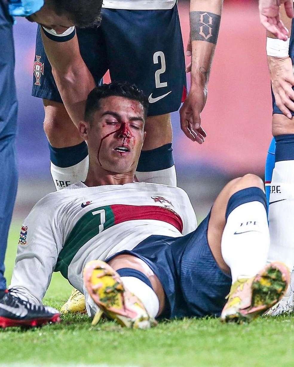 Cristiano Ronaldo sangra bastante durante Portugal x Rep Tcheca — Foto: REUTERS