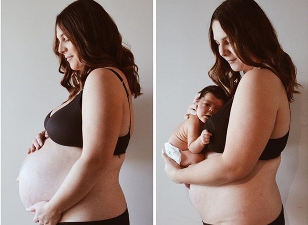 Grávida e após o nascimento (Foto: reprodução/Instagram)
