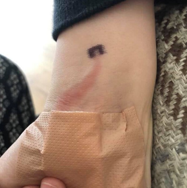 Menino se machuca e contrai infecção grave (Foto: Reprodução: Instagram )