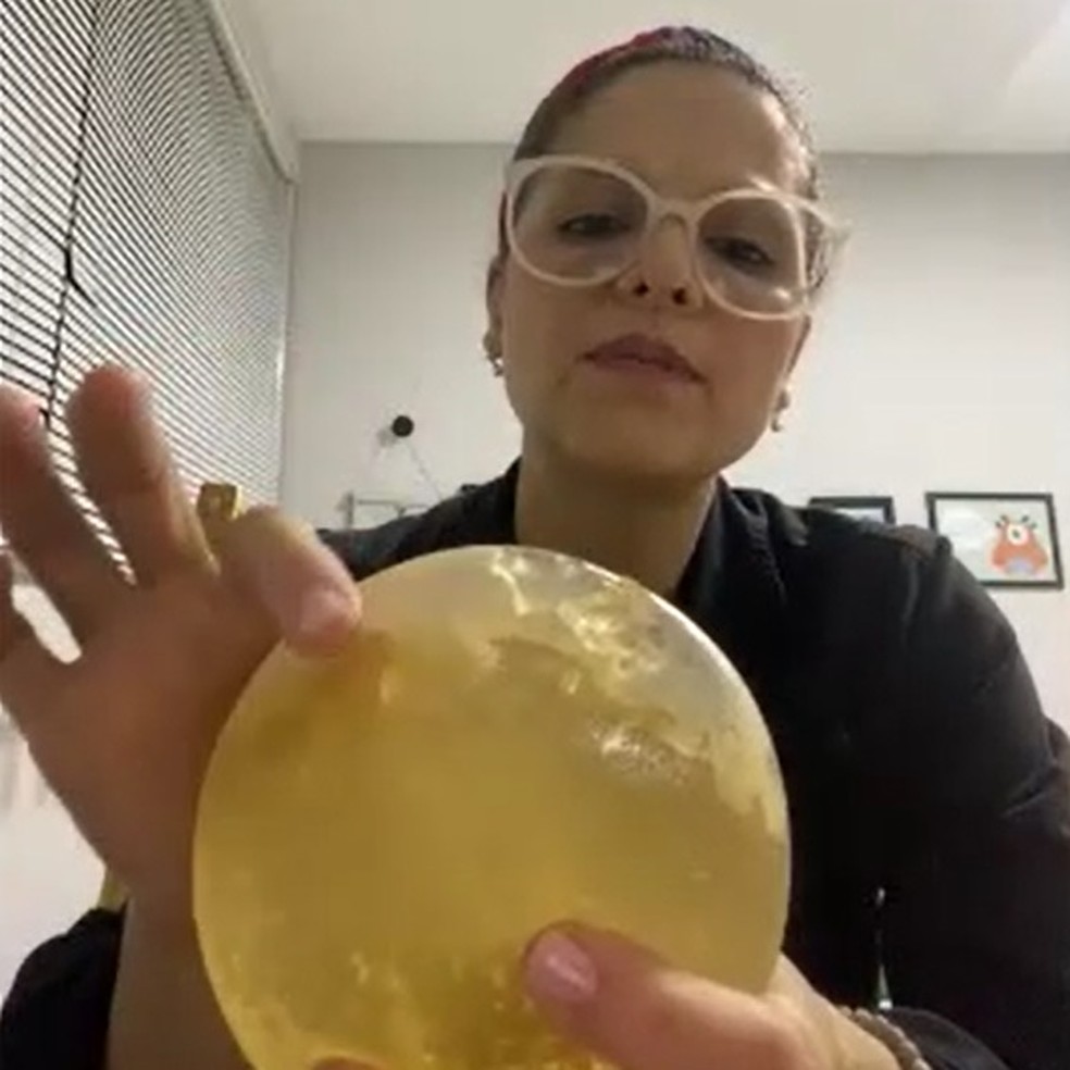 Viviane Assis, que teve problema com prótese de silicone da marca PIP — Foto: Arquivo pessoal