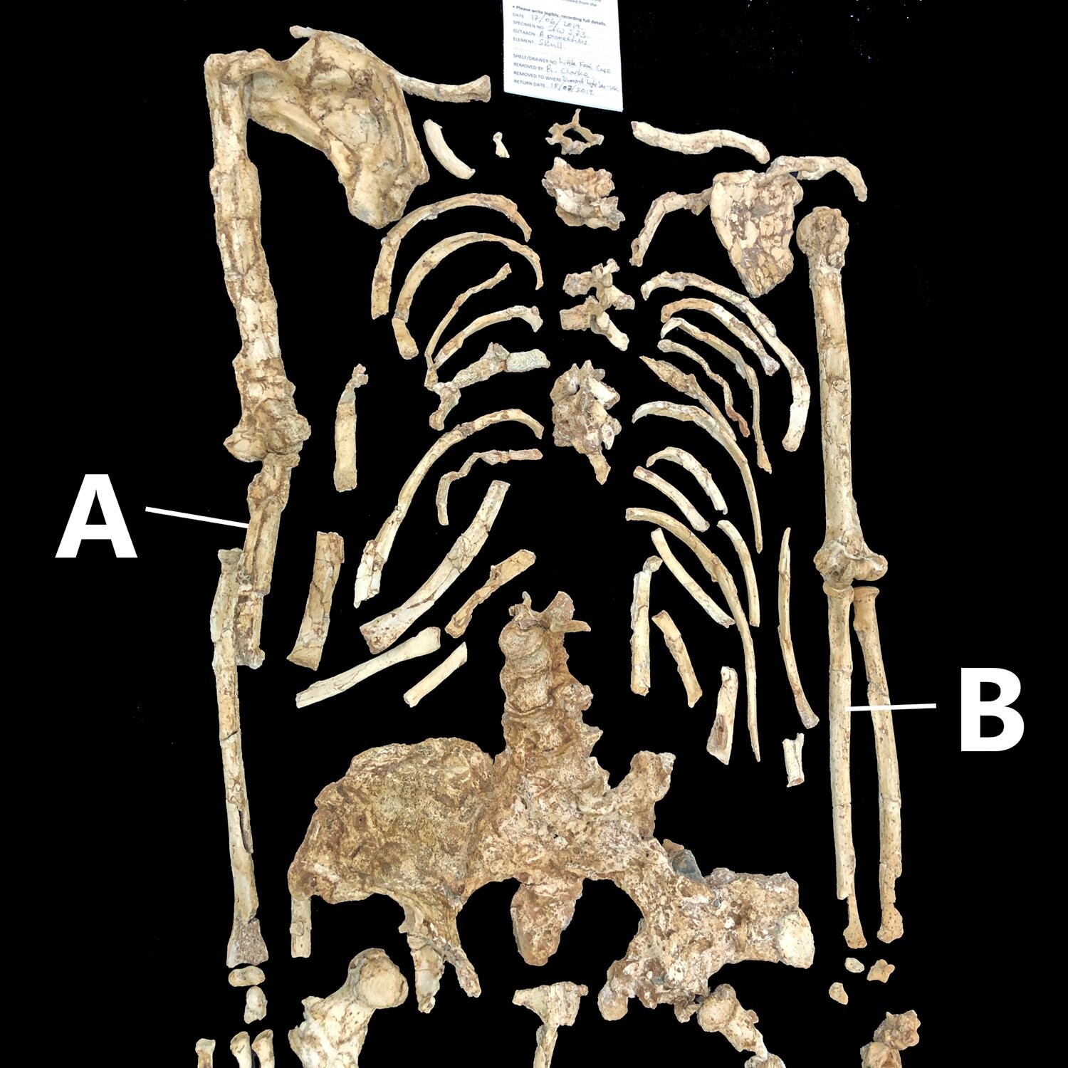 Deformação em fóssil mais antigo de Australopiteco pode ser traço natural. Acima: O esqueleto superior de StW 573 destacando a ulna direita (A) e a ulna esquerda (B). (Foto: Marc R. Meyer)