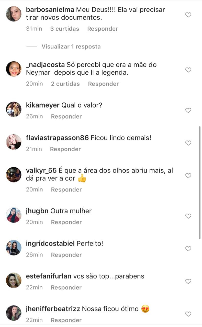 Nadine Gonçalves passa por procedimento estético e internautas comentam (Foto: Reprodução/Instagram)