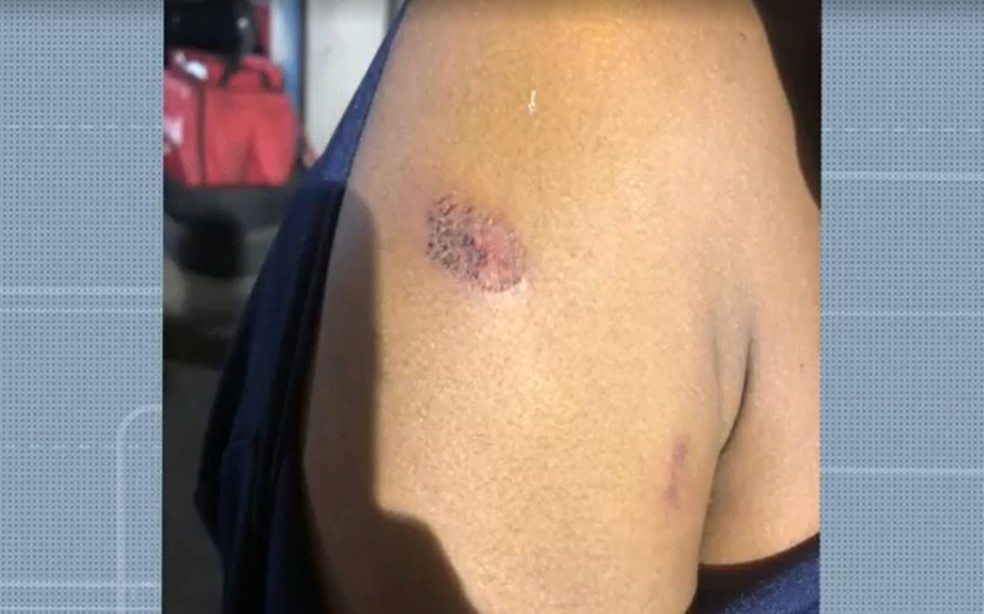 Jovens ficam feridos após agentes da GCM atiraram com bala de borracha durante ação em Salvador — Foto: Reprodução/TV Bahia