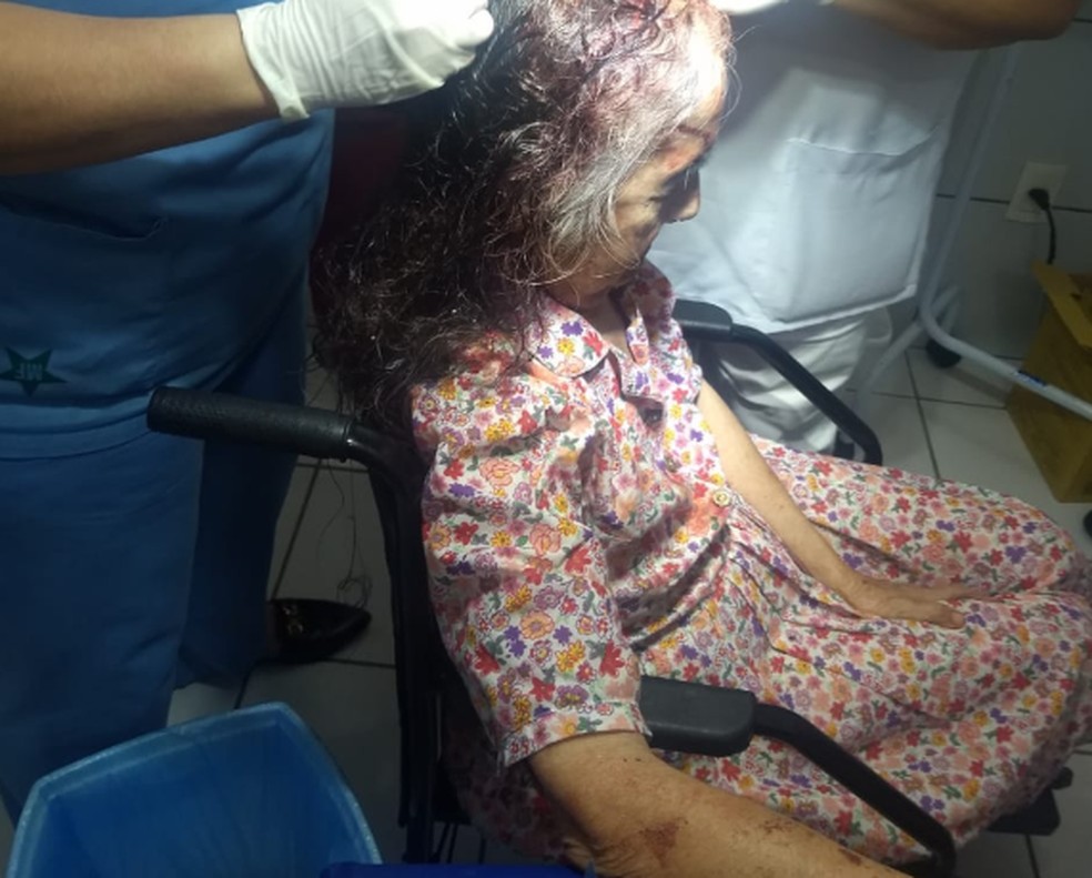 Idosa de 80 anos agredida por assaltantes que invadiram sua casa em Guaiúba — Foto: (Foto: Divulgação) 