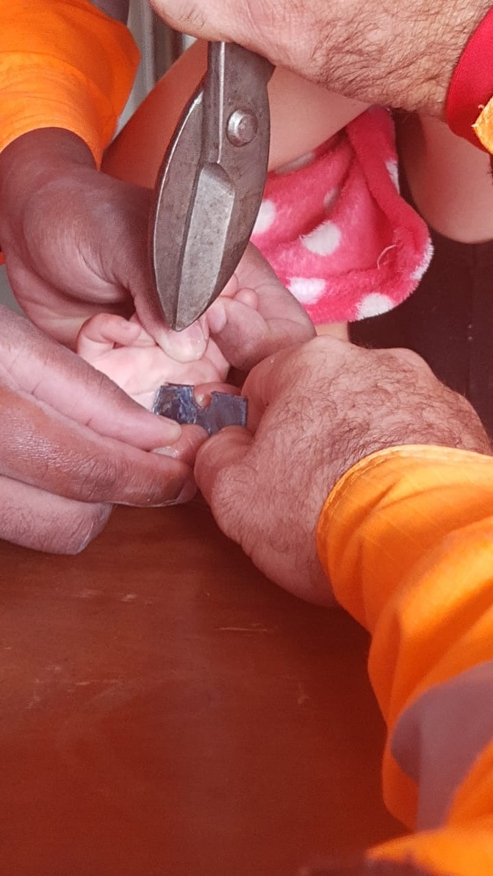 Com uso de uma tesoura, bombeiros conseguiram retirar o dedo da criança — Foto: Corpo de Bombeiros/Divulgação