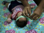 Microcefalia é confirmada em três bebês no Amapá, anuncia MS
