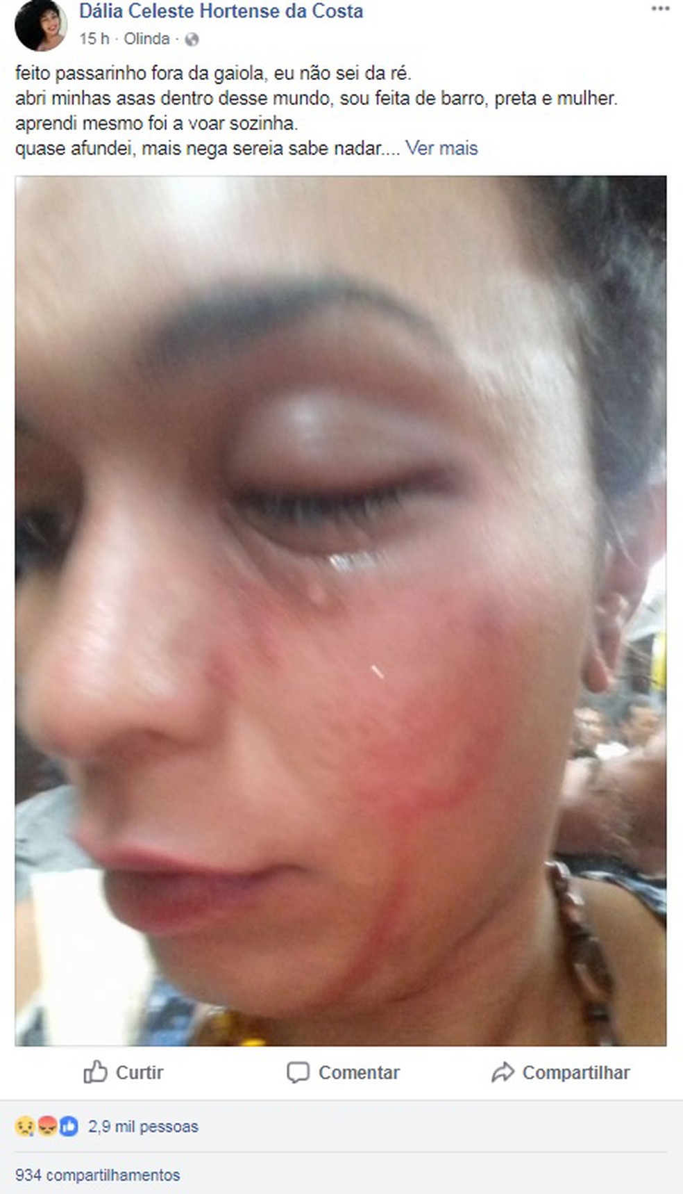 Publicação denunciando agressão a estudante transsexual em universidade do Recife teve milhares de reações no Facebook (Foto: Reprodução/Facebook)