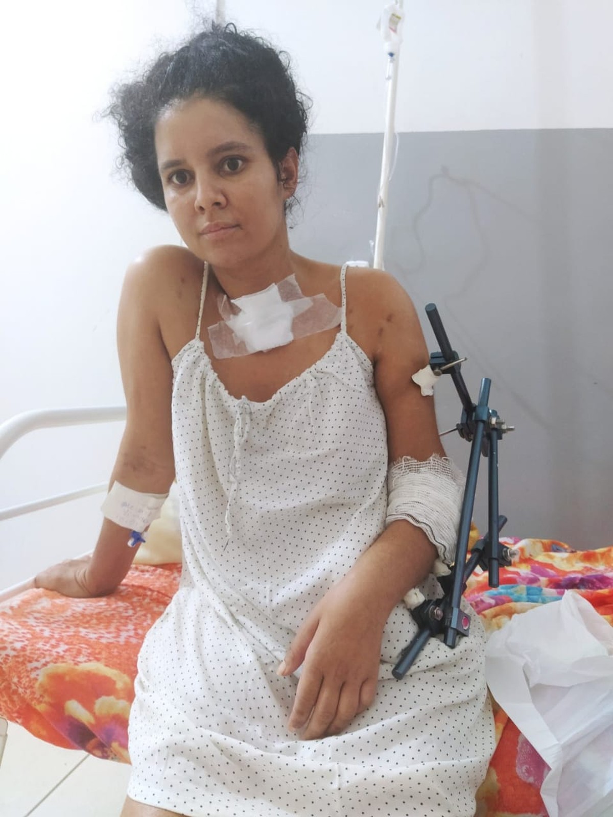 Há 2 meses internada, mulher baleada por ex-marido PM em MT precisa de  cirurgia para recuperar movimento do braço | Mato Grosso | G1