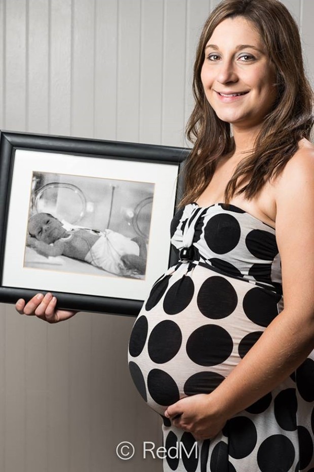 Andréanne, que nasceu com 32 semanas, estava na 26ª semana de gestação no momento em que a foto foi tirada (Foto: Facebook RedM) Andréanne, que nasceu com 32 semanas, estava na 26ª semana de gestação no momento em que a foto foi tirada (Foto: Facebook RedM)