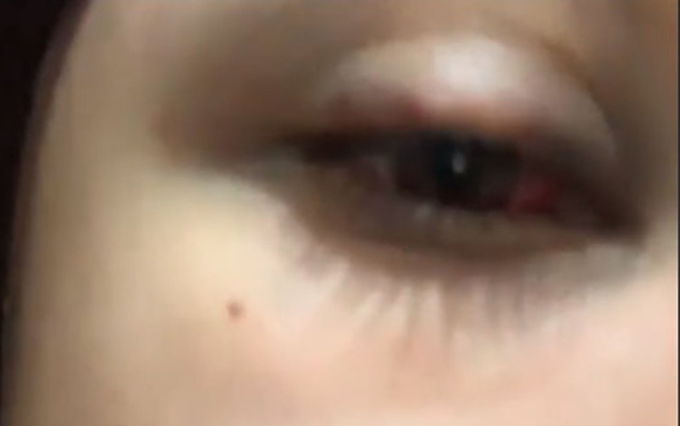 Filha de presidente de Câmara na BA denuncia nas redes sociais agressões físicas feitas pelo pai: 'Meu olho está roxo'. — Foto: Reprodução / Redes Sociais 