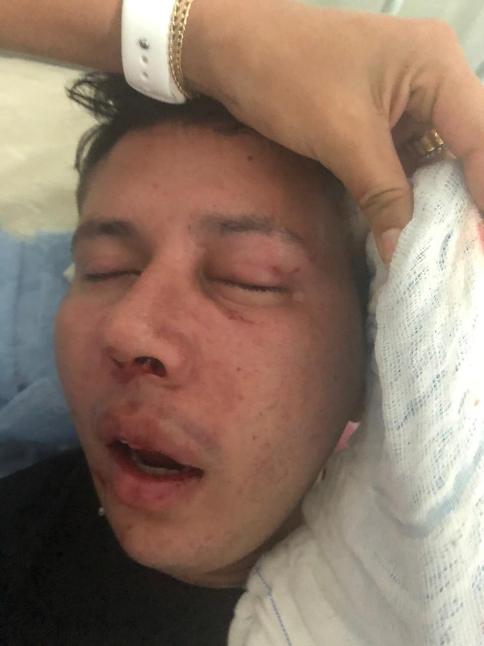 Lucas Figueredo, 28 anos, ficou com rosto deformado — Foto: Arquivo pessoal/Expedito Gomes
