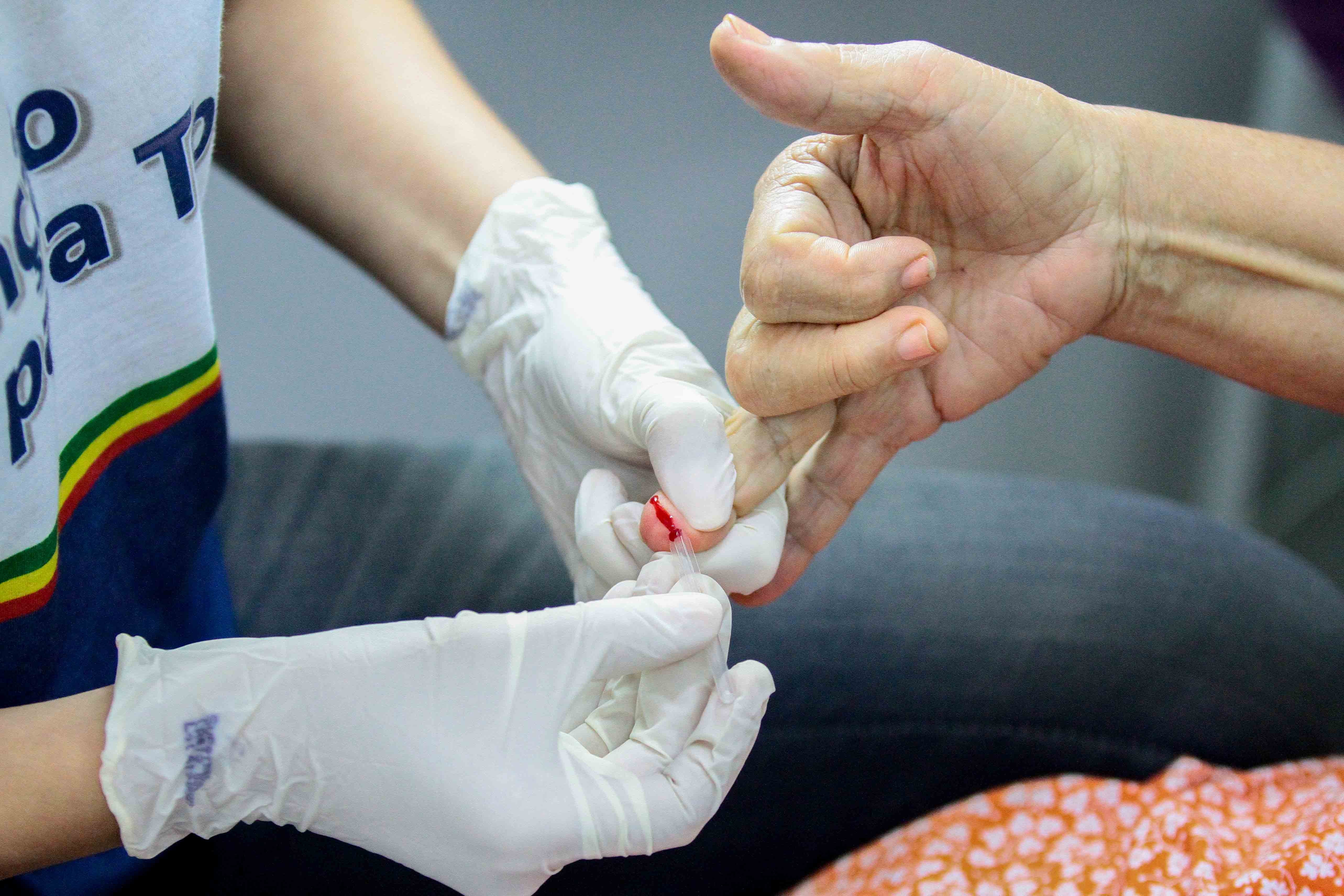 Hepatite em crianças com origem desconhecida tem caso descartado em PE; diagnóstico é de chikungunya
