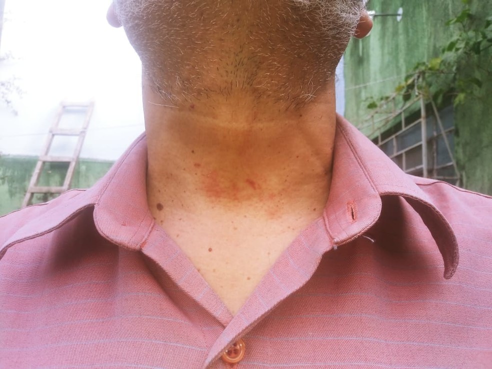 Jornalistas relatam agressões por policiais militares em Alegrete; exame de corpo de delito apontou lesões — Foto: Arquivo pessoal 