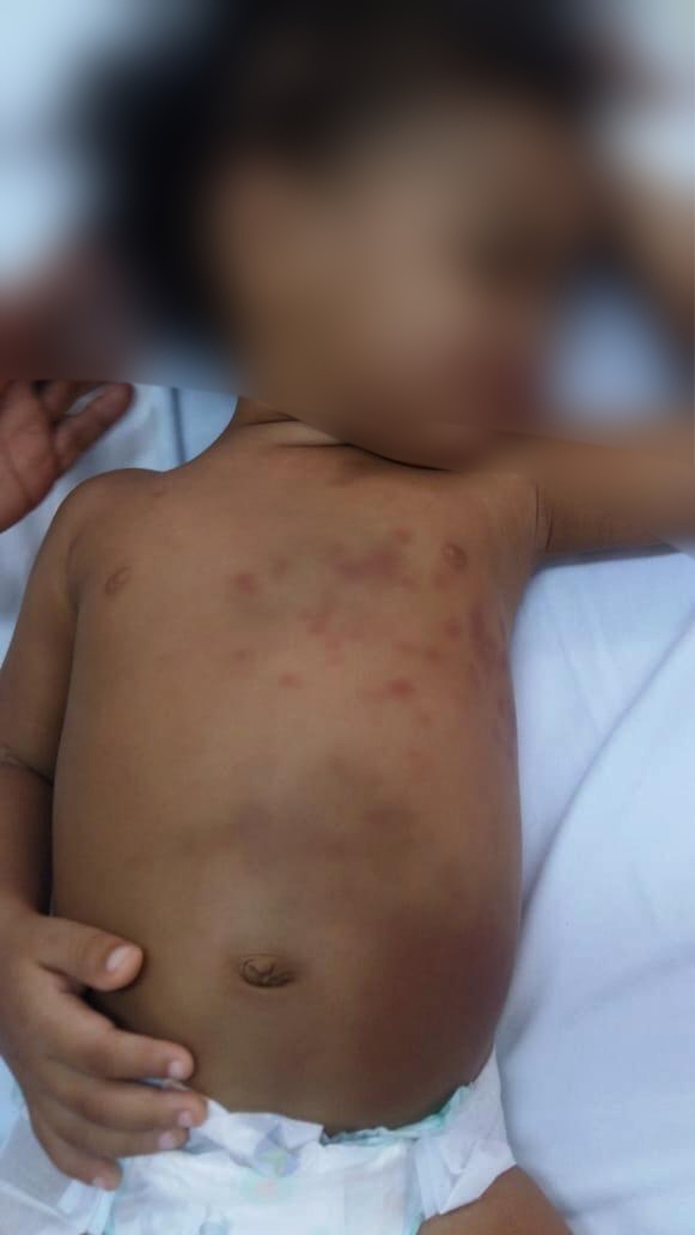 Menina de dois anos deu entrada no Hospital de Presidente Dutra, no Maranhão, após ser espancada pela mãe. — Foto: Divulgação/Polícia Civil